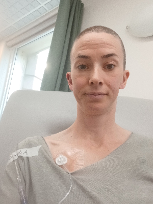 Chemo #2