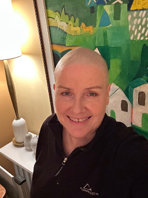 Chemo Days - Glad to have hair back now!